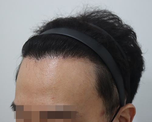 6 12개월 3.jpg