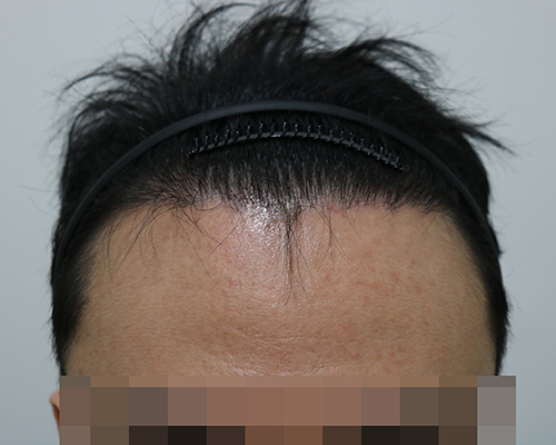 2 6개월.jpg