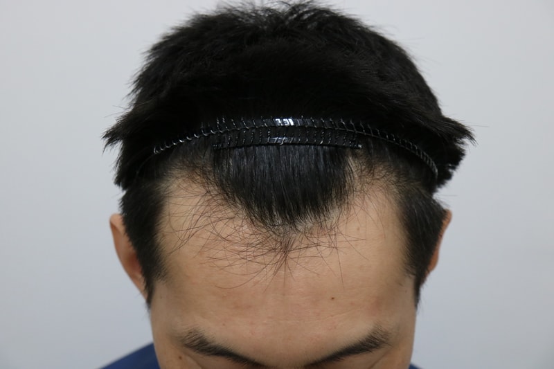1.JPG