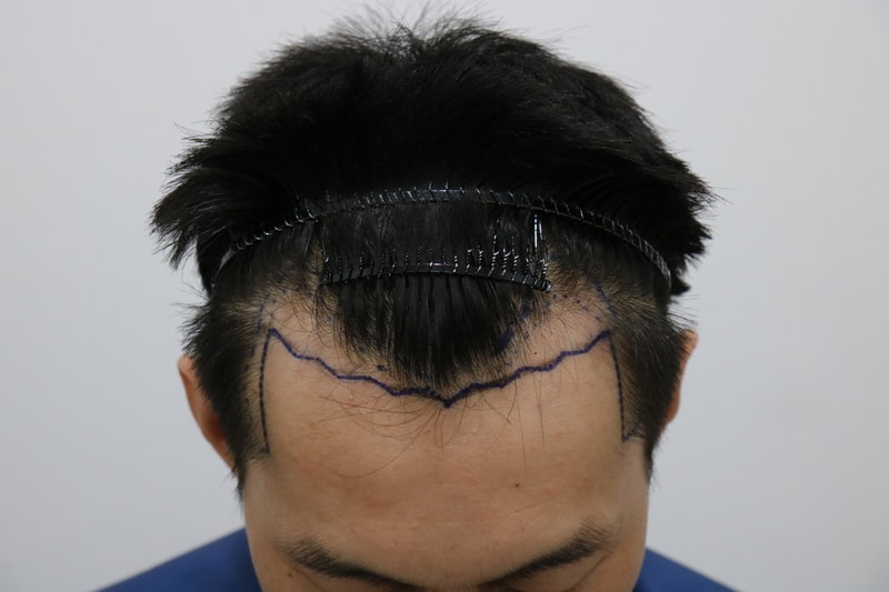 2.JPG