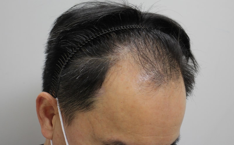 04.4달전.JPG