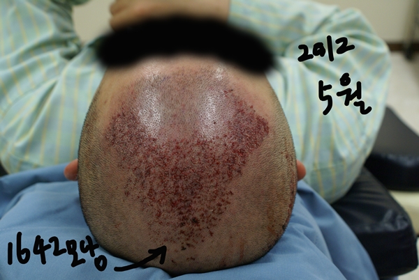 깐두리 (2).JPG