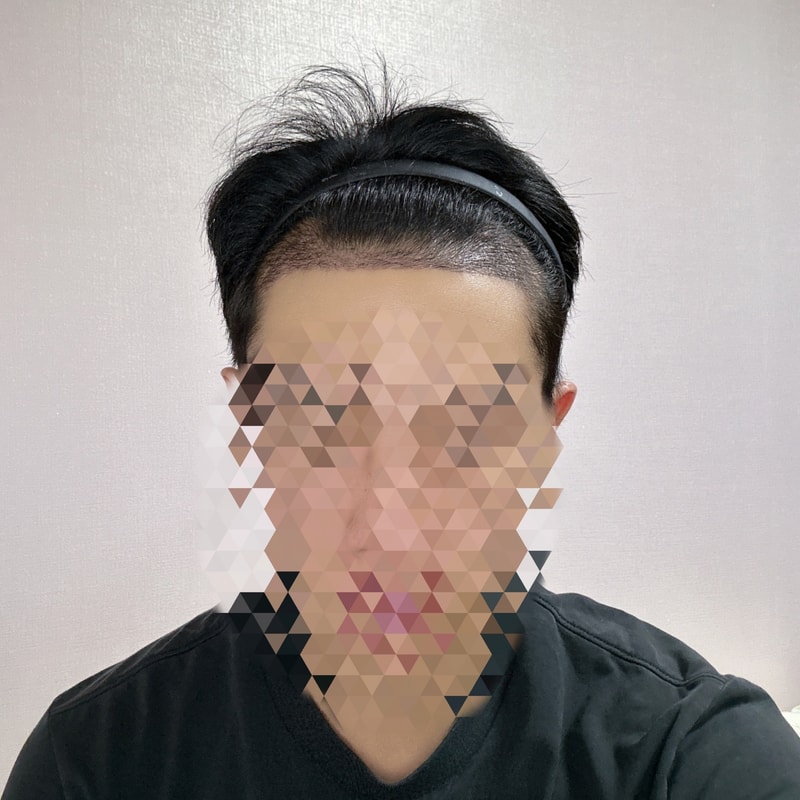 수술3주차.jpeg