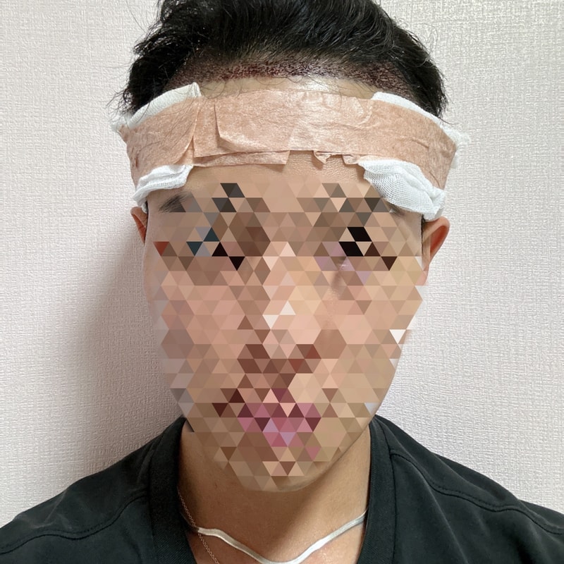 수술당일.jpeg
