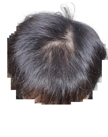 111.png