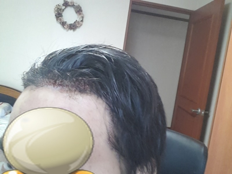 수술당일1.jpg