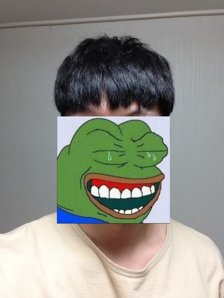 수술 1년차 후기 사진이랑 같이 올려요~