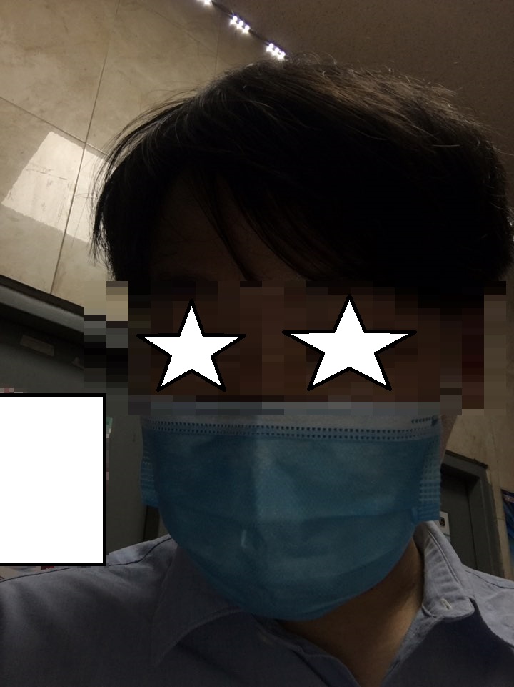 비절개 수술한지 3년 됐습니다.