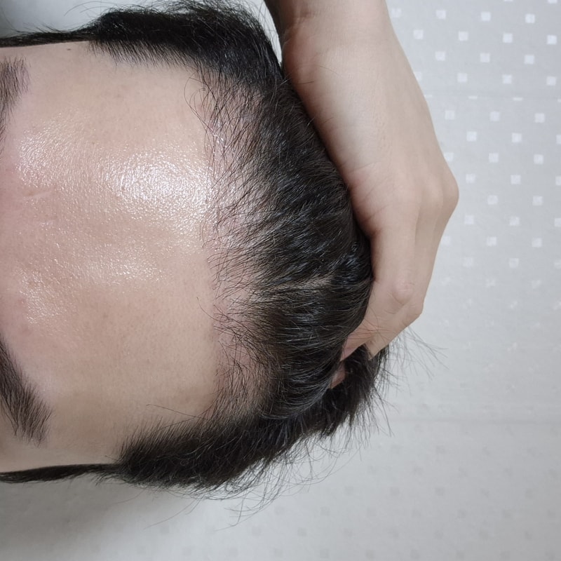 모제림 박세호 원장님 3개월차 후기!
