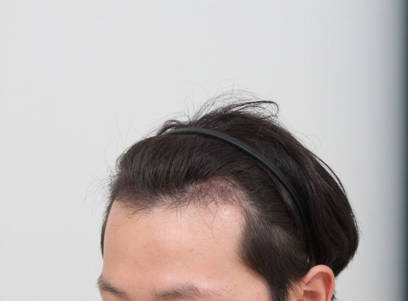 4개월후 3.JPG
