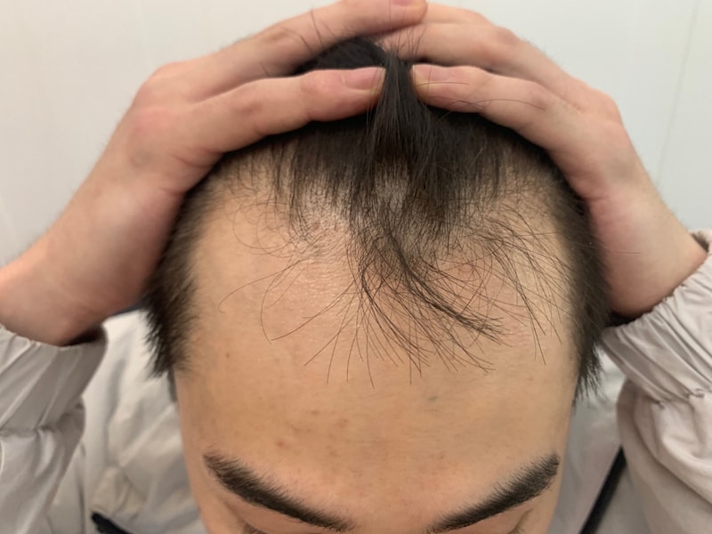 2달차 암흑기를 이겨내고 조금씩 자라는 중