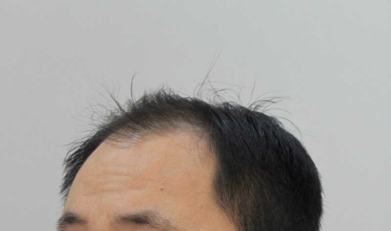 전 3.JPG