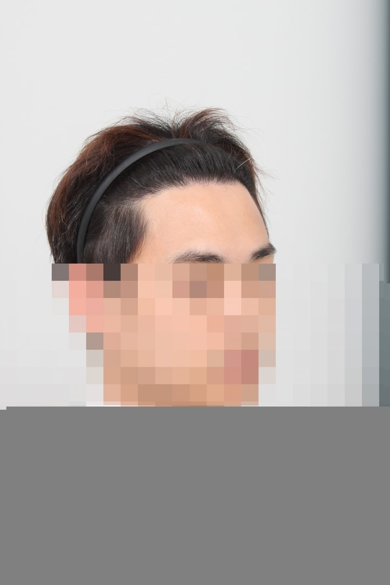 후 3.JPG