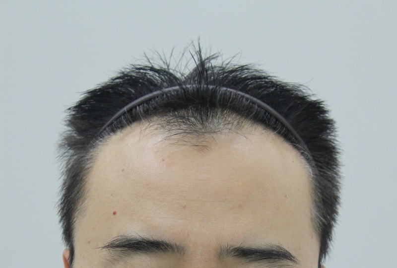 전 3.JPG