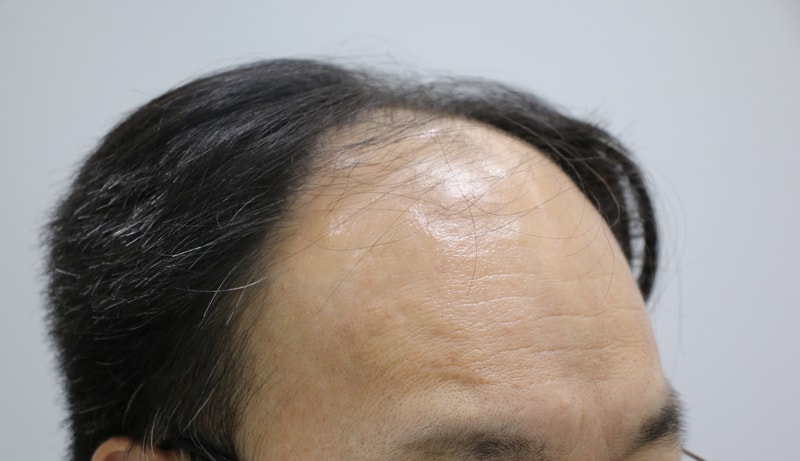 전 1.JPG