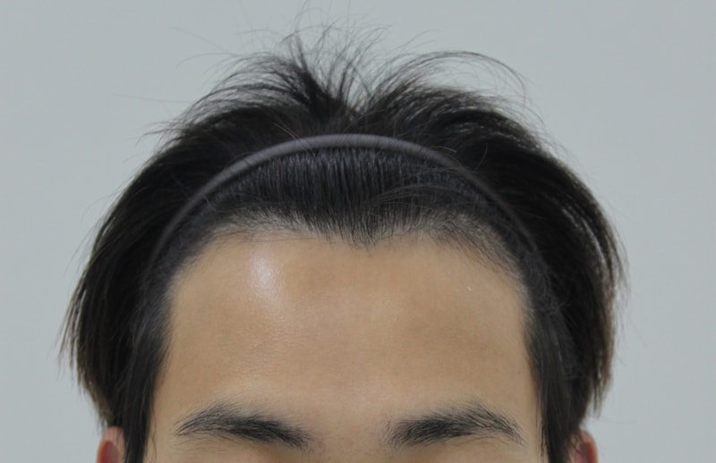(포헤어 데일리후기) 1년후기입니다