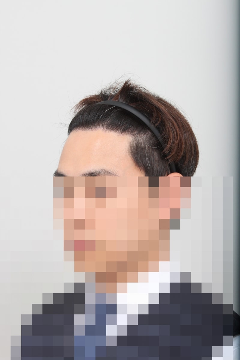 후 1.JPG