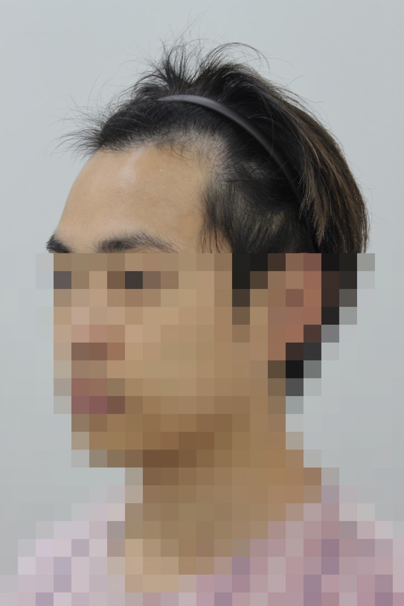 전 3.JPG