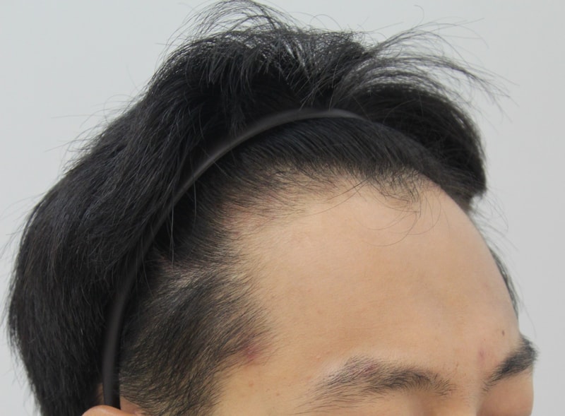 전2.JPG