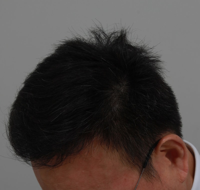 후 1.JPG