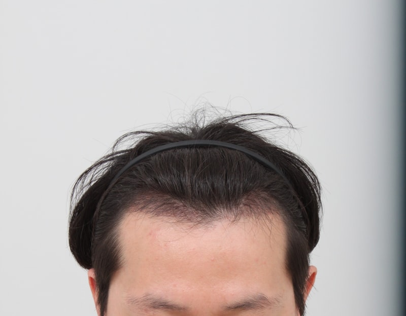 4개월후 2.JPG