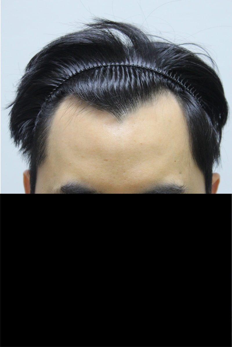 전 1.JPG