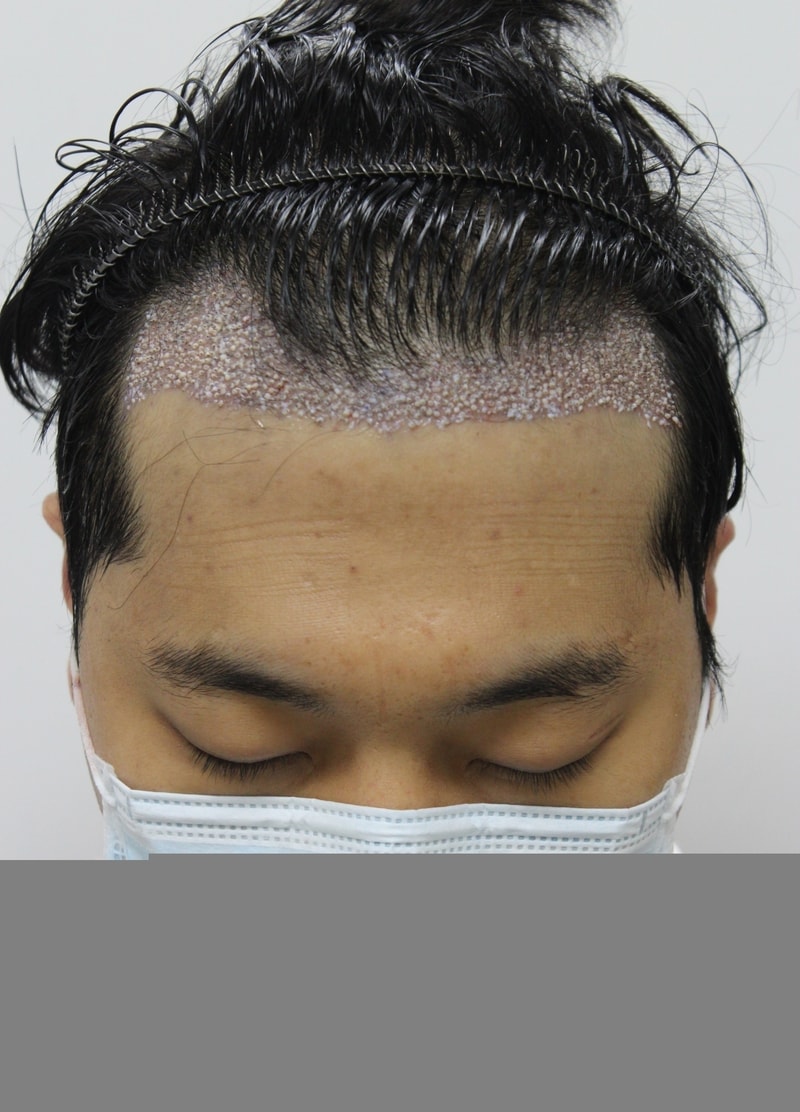 후 2.JPG