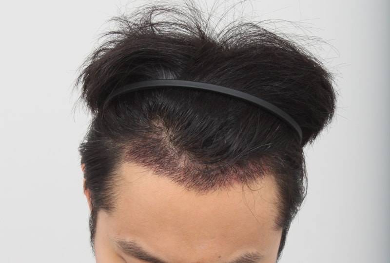 3주1.JPG