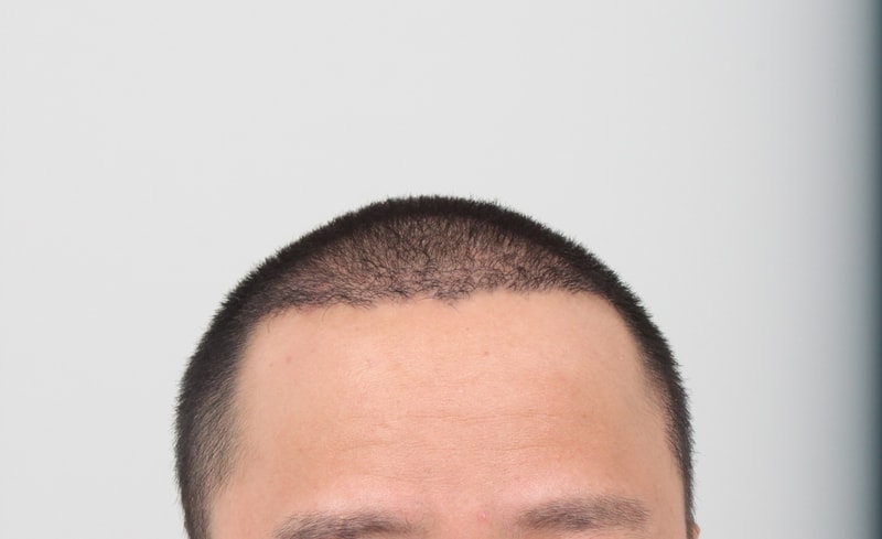 3개월후 2.JPG