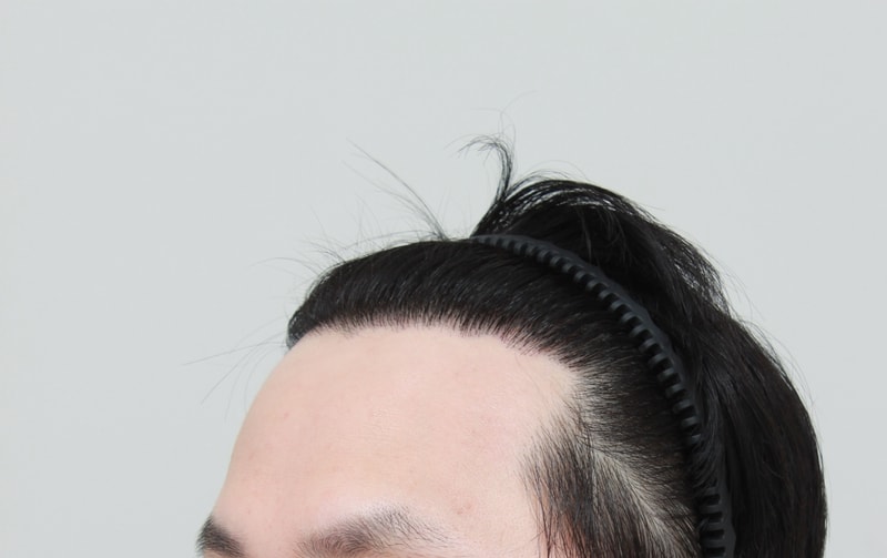 후 2.JPG
