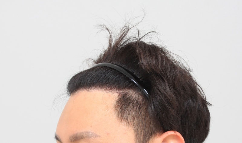 7개월후 3.JPG