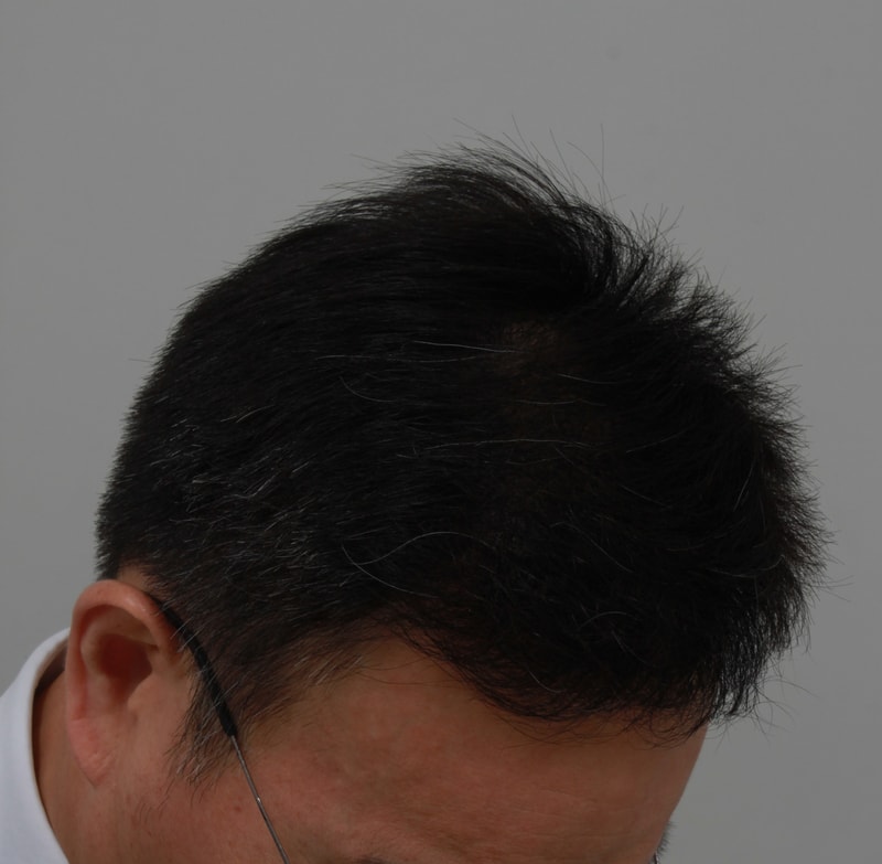 후 5.JPG