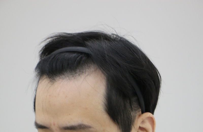 전 3.JPG
