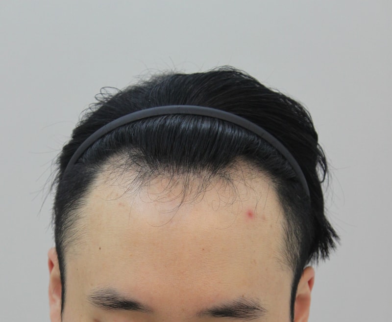 전 2.JPG