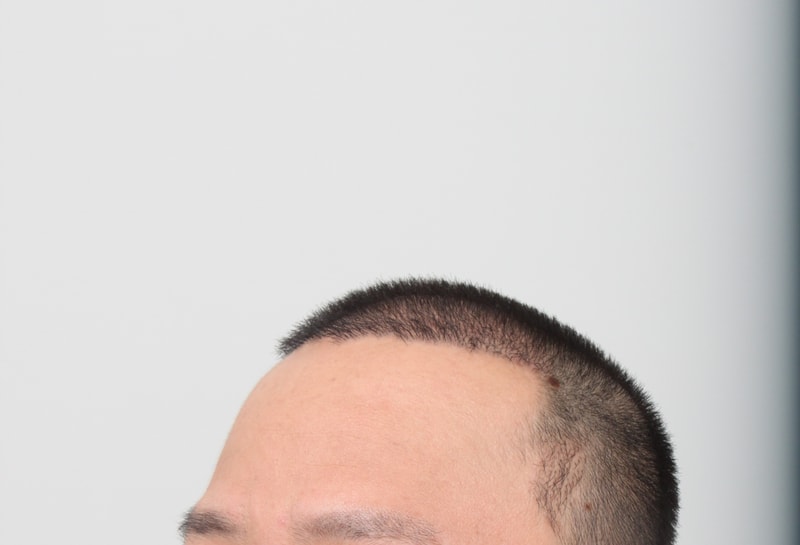 3개월후 1.JPG