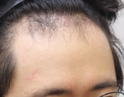 암흑기 측면2.PNG