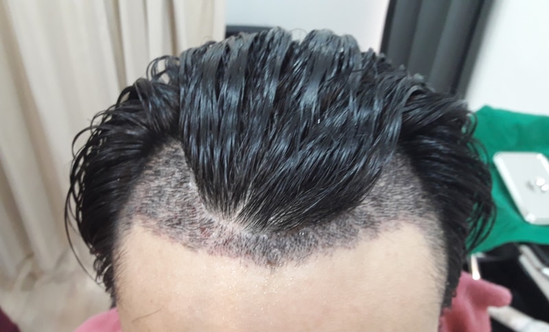 KakaoTalk_20180309_124155000 (2).jpg
