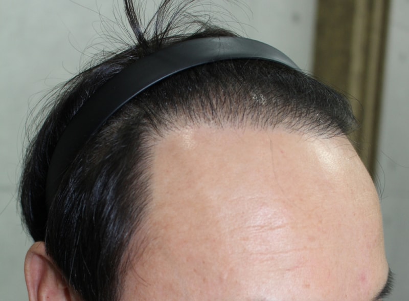 IMG_5079_1년.JPG