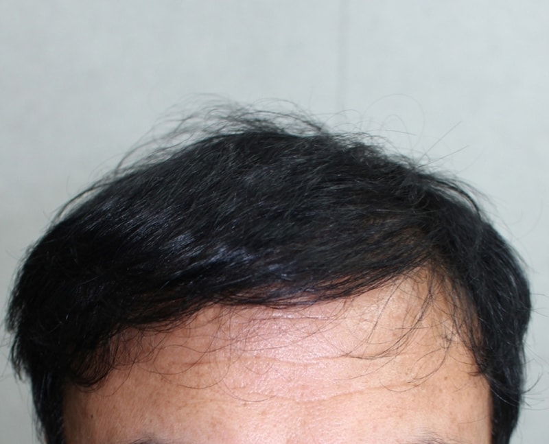 IMG_1978_1년.JPG
