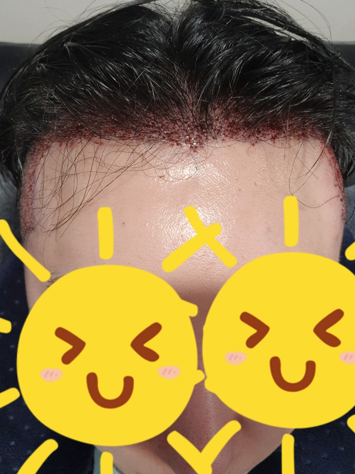 수술후1.jpg