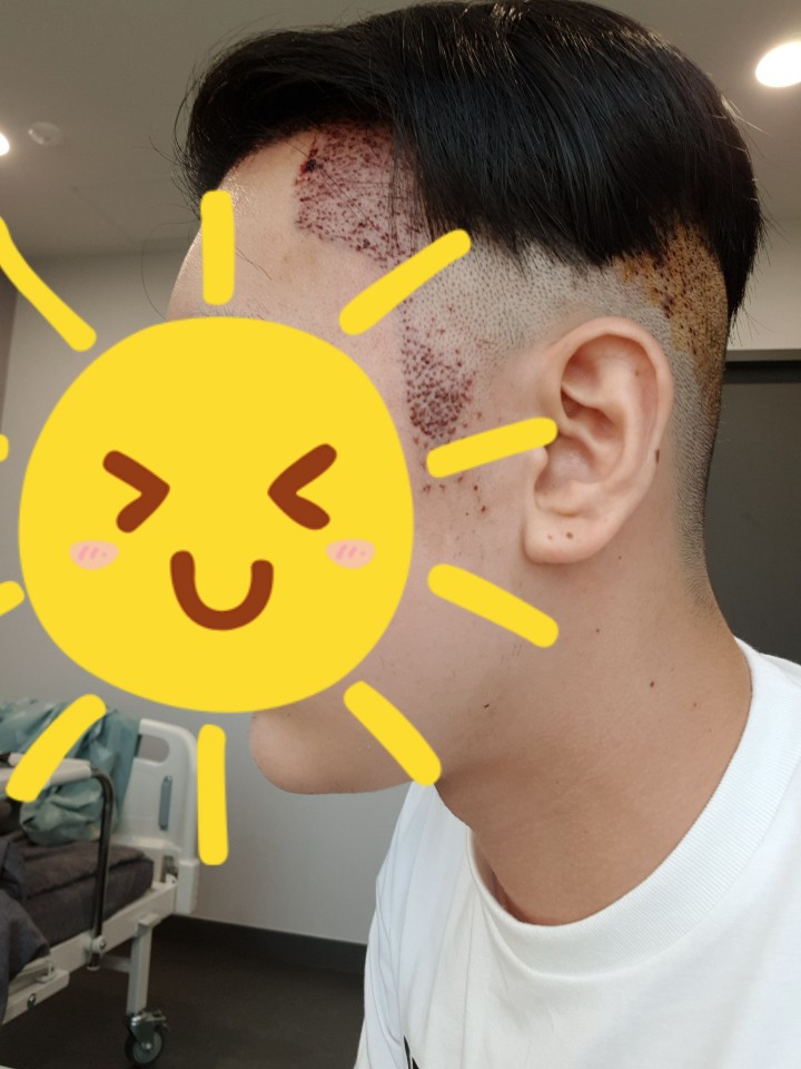 수술후5.jpg