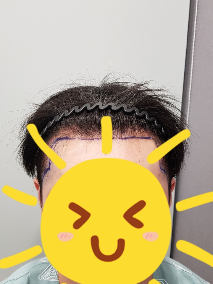 수술전1.jpg