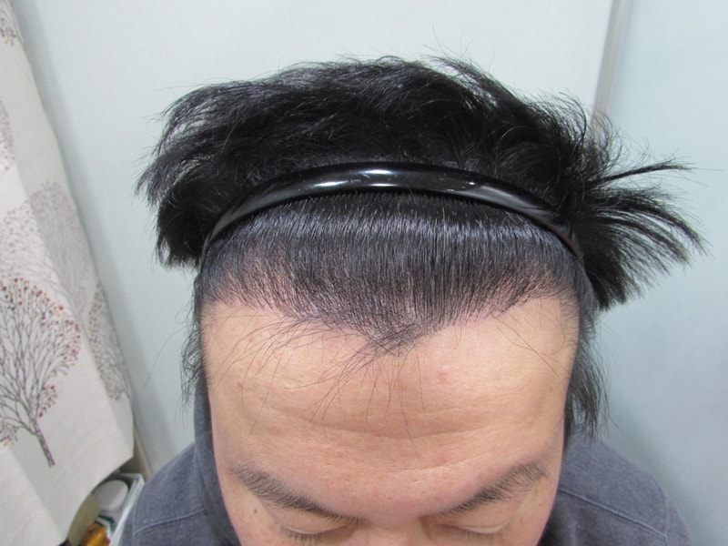 10개월후.jpg
