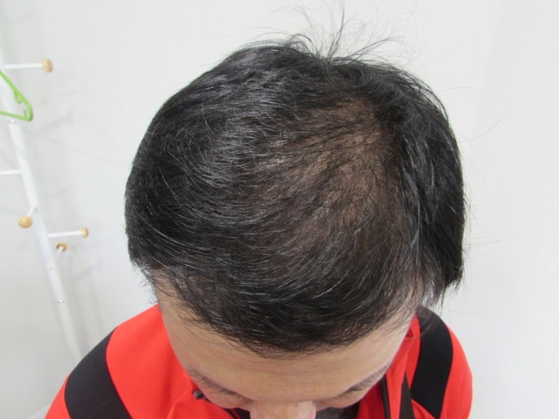 수술전 (2).jpg