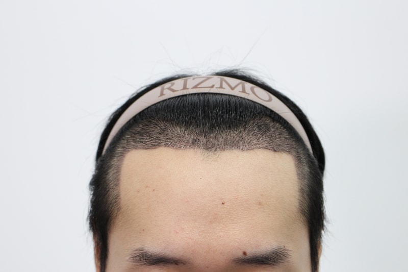 수술후1.jpg