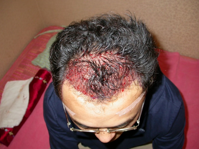 9월8일 수술장면.jpg