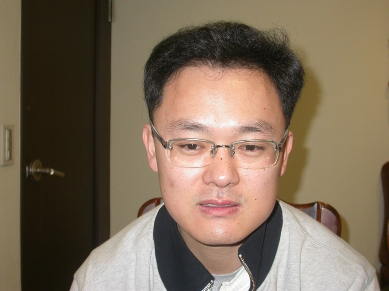 수술175일째(이마).jpg
