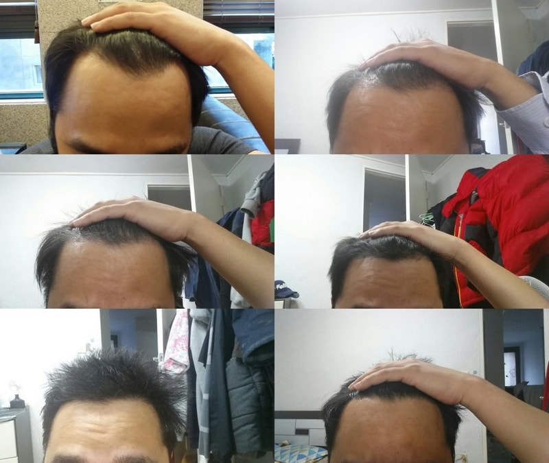 흐익.jpg