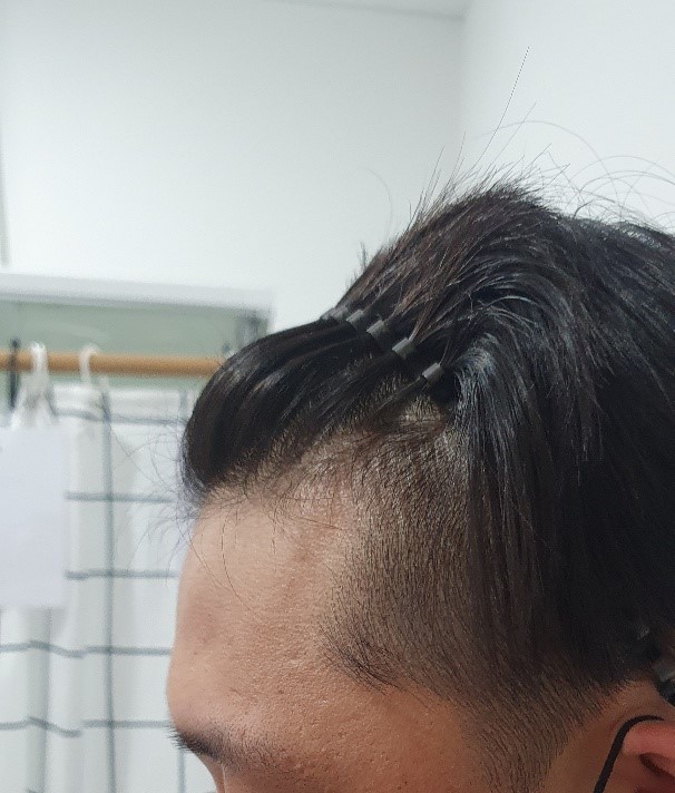수술전4.jpg