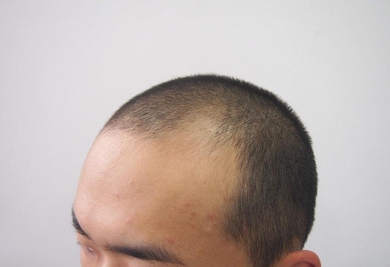 수술 전4.jpg